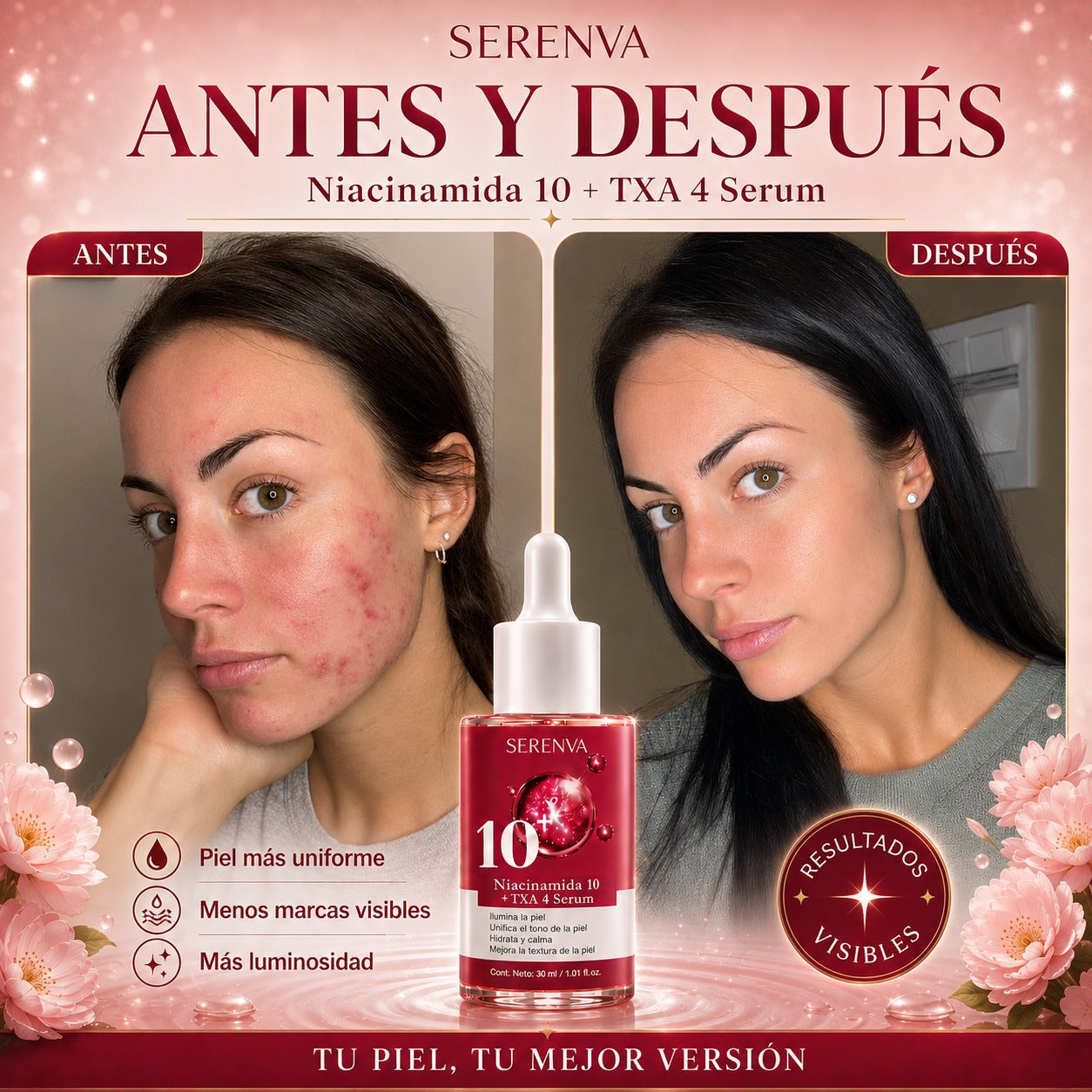 Serenva® Adiós Manchas Oscuras