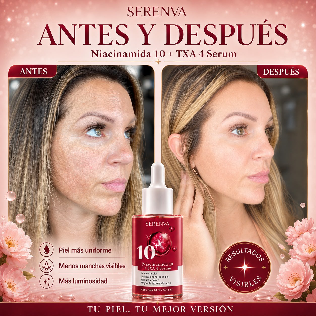 Serenva® Adiós Manchas Oscuras